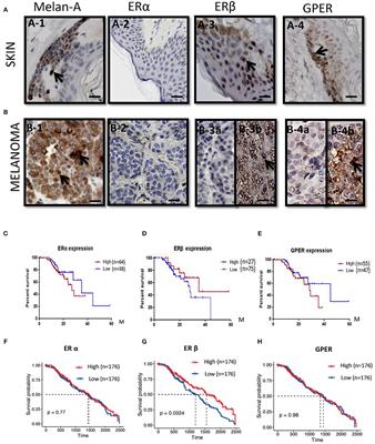 Cyanidin-3-o-Glucoside Pharmacologically Inhibits Tumorigenesis via Estrogen Receptor β in Melanoma Mice